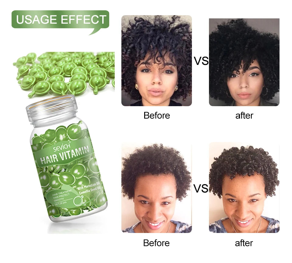 Capsules de vitamines kératine et huiles essentielles - Sérum marocain anti perte de cheveux